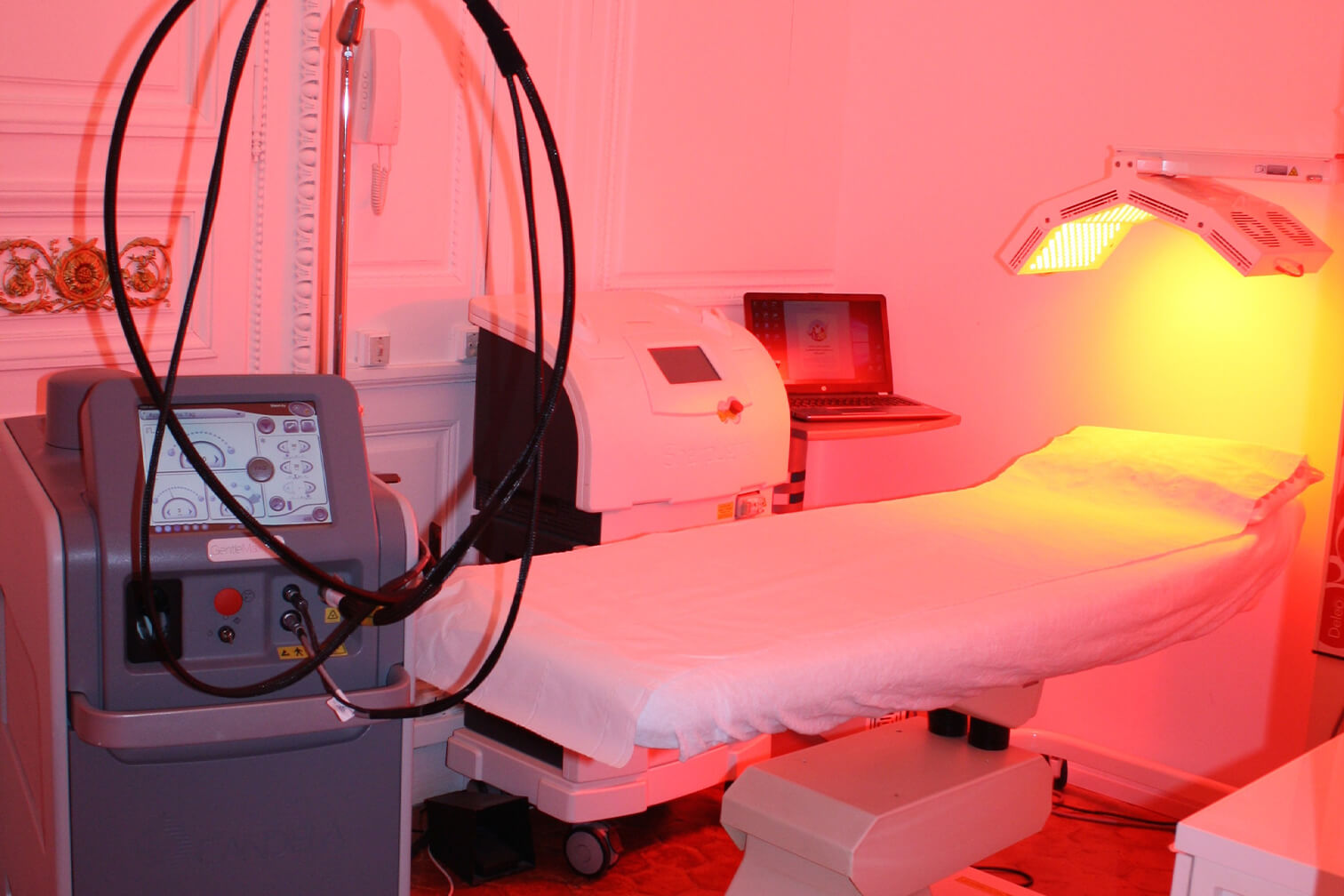 épilation laser definitive